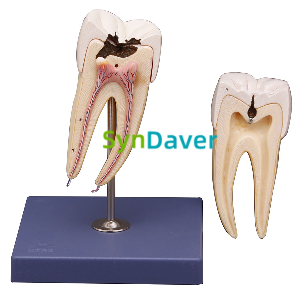 d498dc57e2c2e49c4e88a57b019b02d8